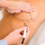 Is Cosmetic Surgery Right for Me? Exploring the Benefits and Risks of Different Procedures